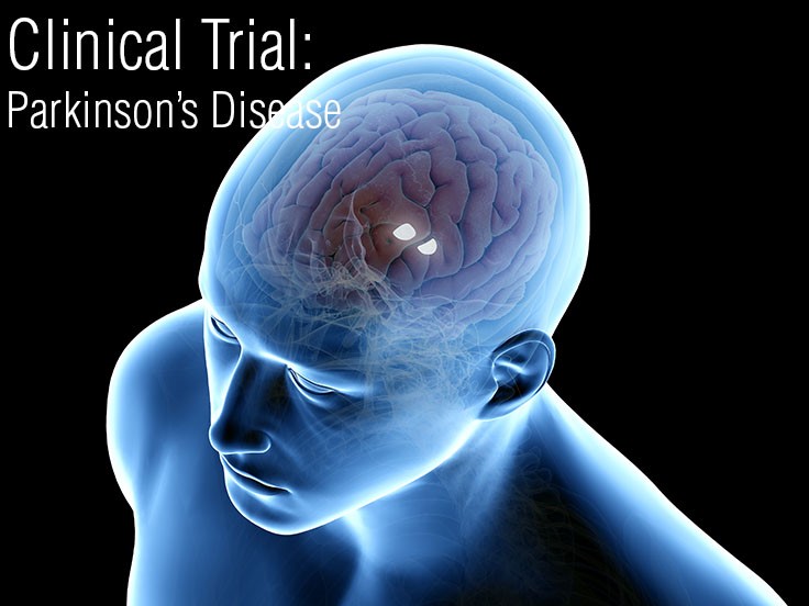 UK Research Institution Studying CBD for Symptoms of Psychosis in Parkinson's Patients 